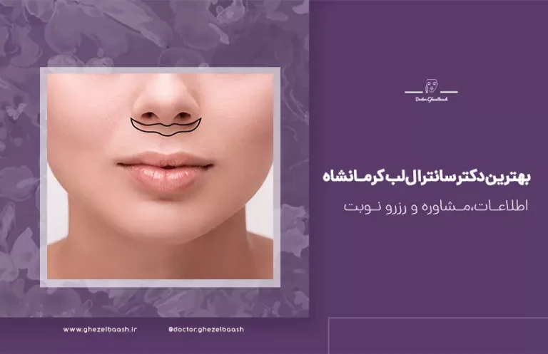 بهترین دکتر سانترال لب کرمانشاه